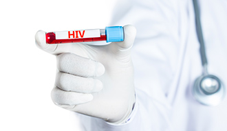 HIV Antibody & P24 Antigen