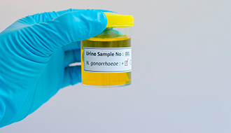 Gonorrhoea Test