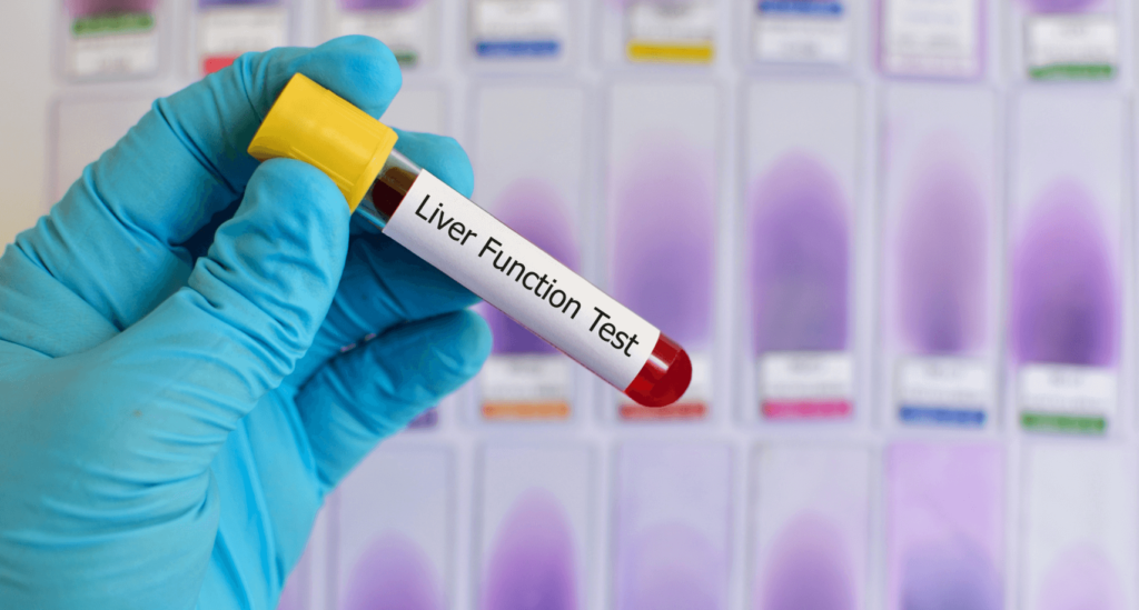 blood vial for Liver Function test