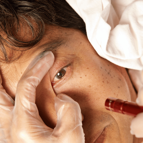 close up of an eye with doctor checking for eye infections