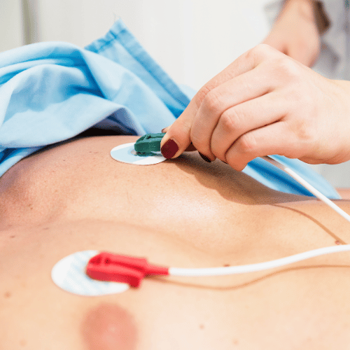ECG electrodes on the patient