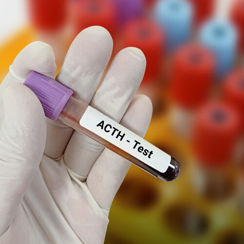 ACTH Blood Test - Private Blood Tests In London