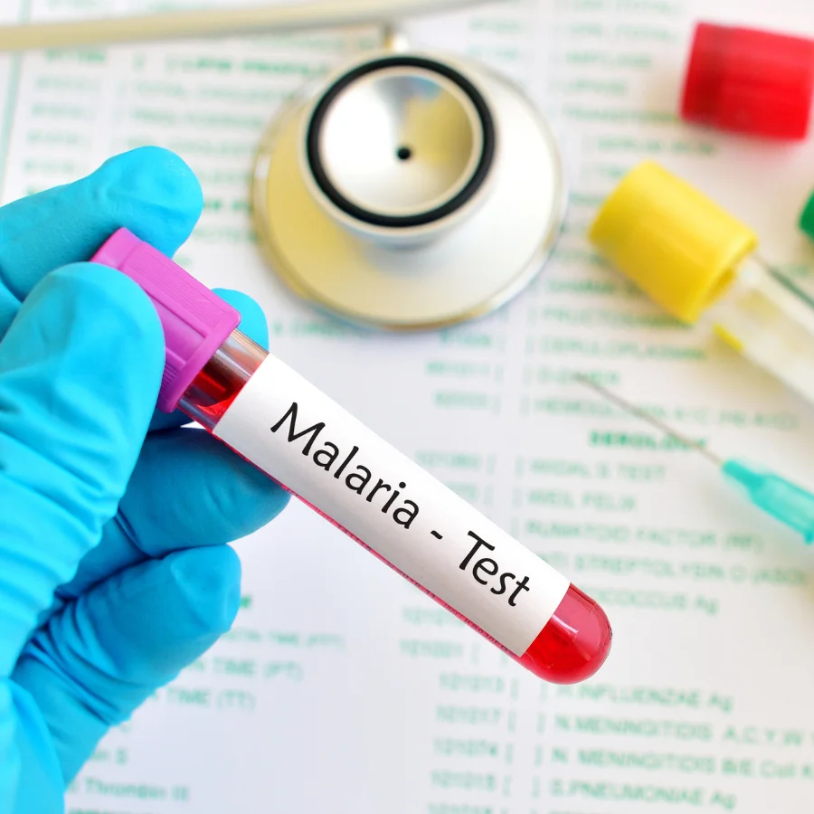 malaria blood test vial