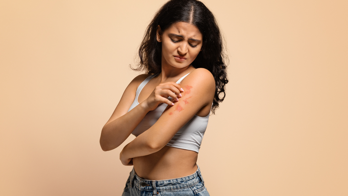 Woman scratching red itchy rash on her upper arm
